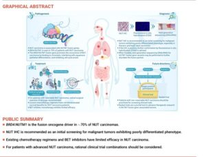 Expert consensus on the diagnosis and treatment of malignant peritoneal mesothelioma